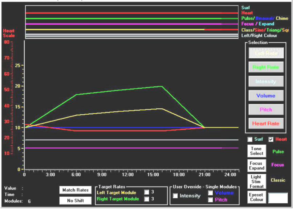 SMR/Beta session ADD kezelésre – ADHD gyerekek protokollja (MindAlive, 2022)